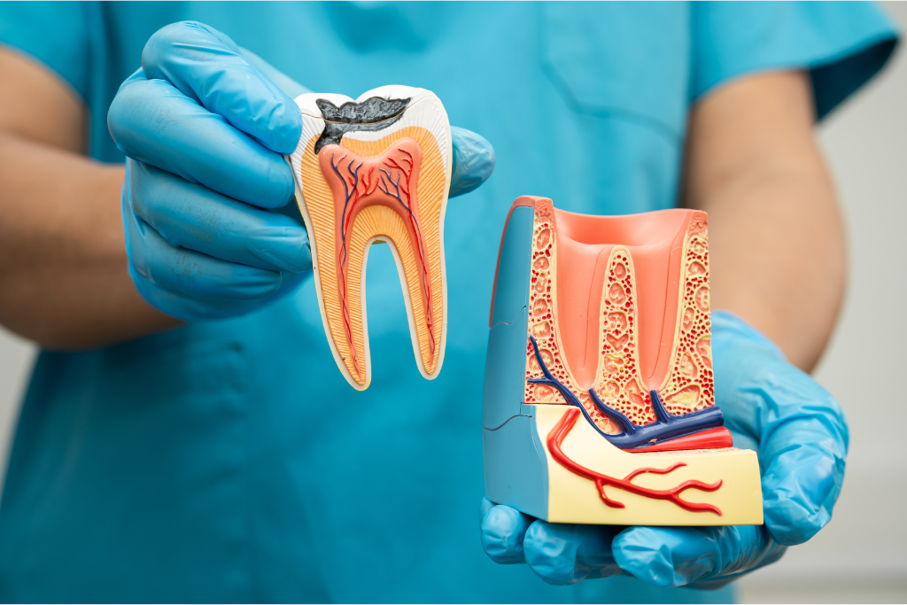 dental implants in Boca Raton