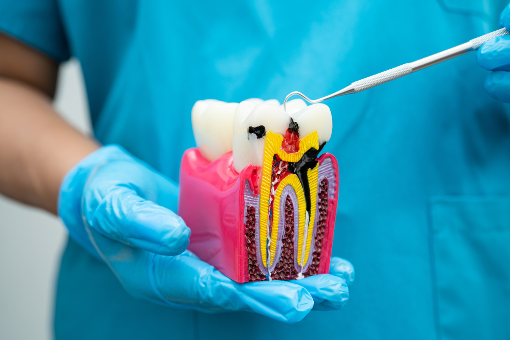 dental implants in Boca Raton
