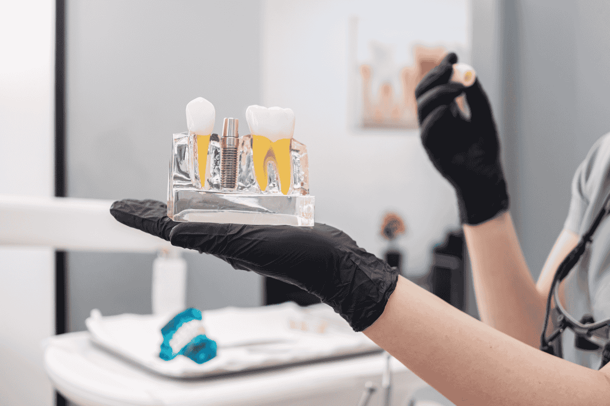 Dental professional holding acrylic model showing tooth implant options and components.